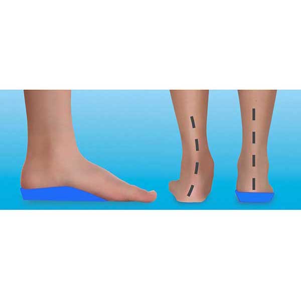Footlogics KIDS 3/4 LENGTH Orthotics